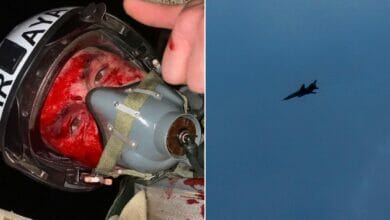 انتشرت صورة السيلفي الدموية للطيار المقاتل – تحكي عن الليلة الدرامية