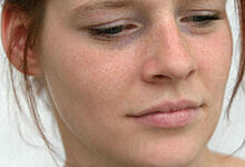 قلة النوم: كيف تجعل بشرتك متوهجة