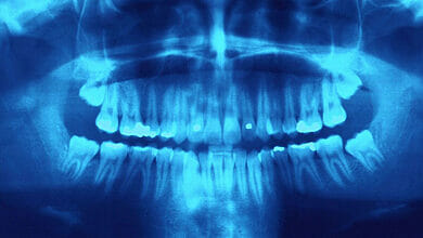 طبيب الأسنان يكشف عن العادة البسيطة المروعة لأسنانك