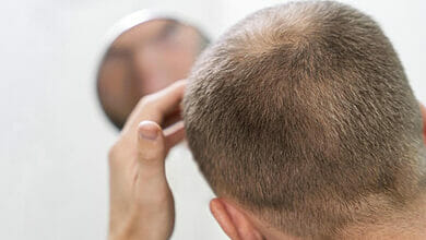 هل تم اكتشاف علاج لتساقط الشعر؟ يقول العلماء أن لديهم الحل