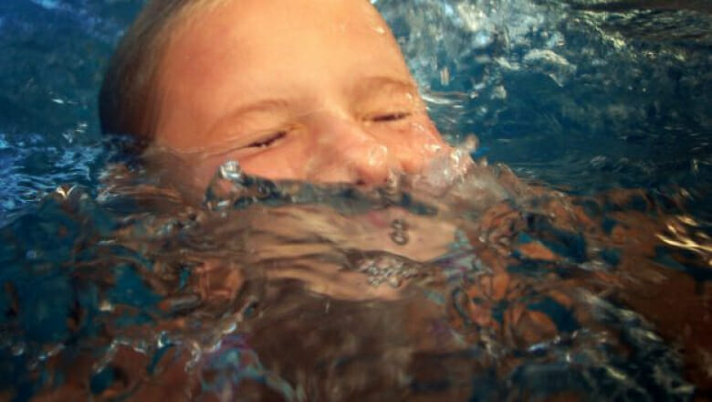 يوصي أطباء الأطفال بالحذر من ضربة الشمس والسباحة